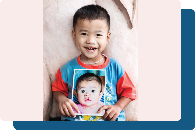 Operation Smile Paro Plateau Clinique de parodontie et d'implantologie du Plateau Montreal Clinique Dentaire Dentistes