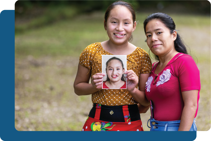 Operation Smile Paro Plateau Clinique de parodontie et d'implantologie du Plateau Montreal Clinique Dentaire Dentistes